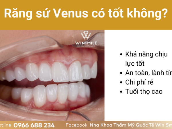 Răng sứ Venus có tốt không? Cách chăm sóc răng miệng để răng sứ Venus sau khi bọc luôn chắc khỏe!