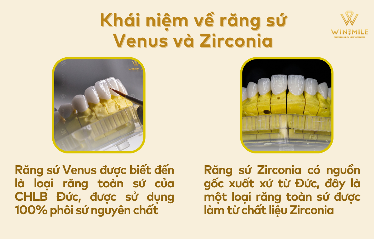 Răng Sứ Venus Và Zirconia: So Sánh, Ưu Điểm và Lựa Chọn Tốt Nhất