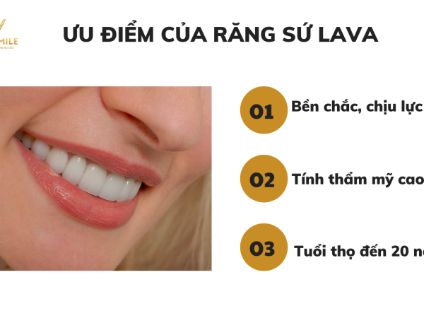 Răng sứ Lava là gì? Có nên chọn răng sứ Lava không?