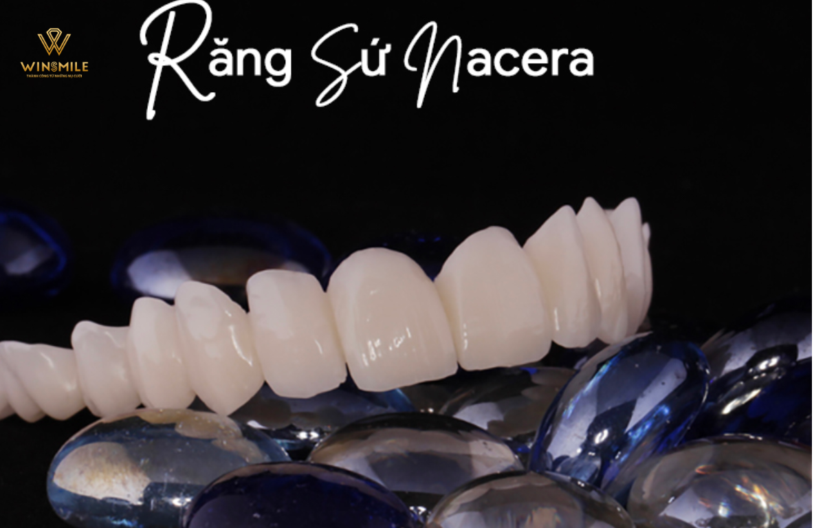 Răng dán sứ veneer Nacera cho khả năng chịu lực tốt