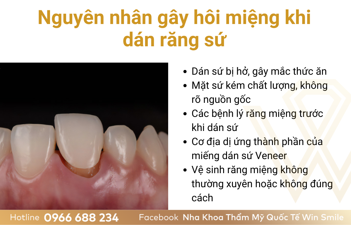 Nguyên nhân gây hôi miệng khi dán răng sứ