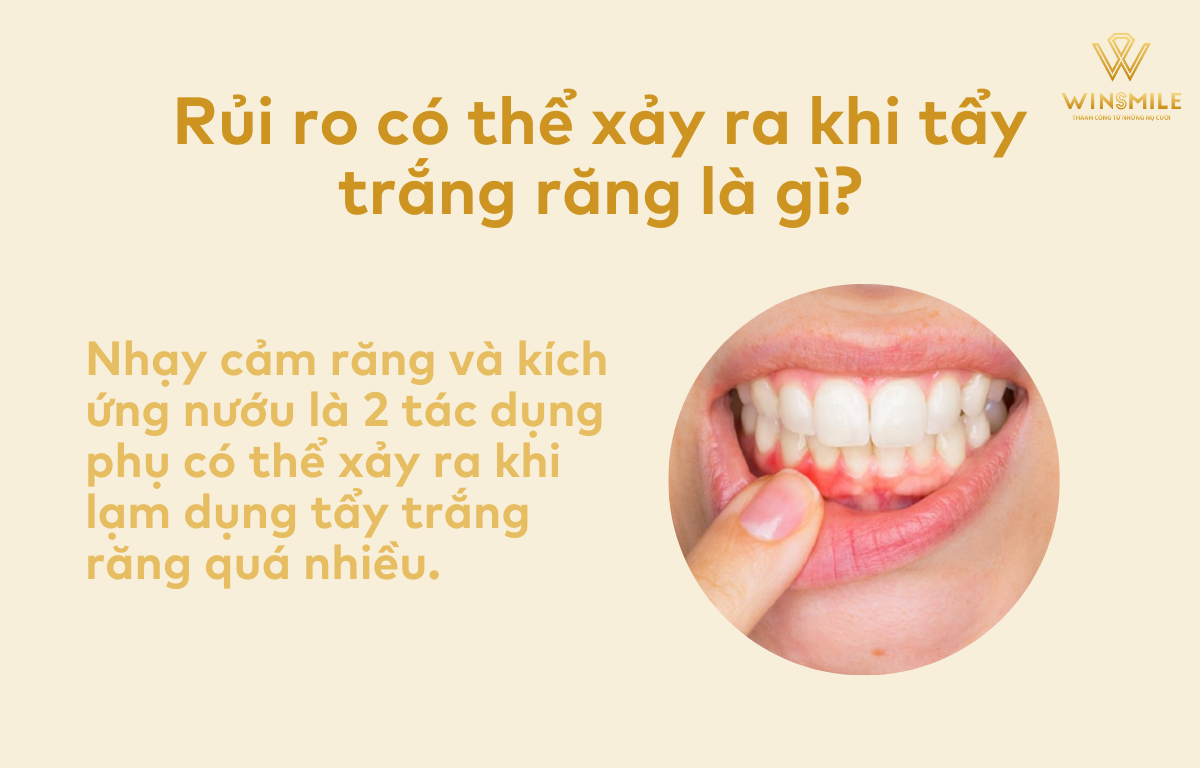 Rủi ro có thể xảy ra khi tẩy trắng răng