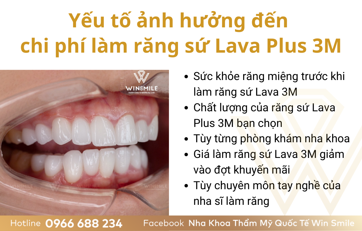 yếu tố ảnh hưởng đến chi phí làm răng sứ Lava Plus 3M