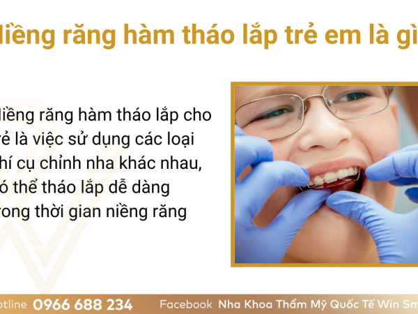 Niềng răng hàm tháo lắp trẻ em là gì? Có nên sử dụng phương pháp niềng răng bằng hàm tháo lắp cho trẻ hay không?