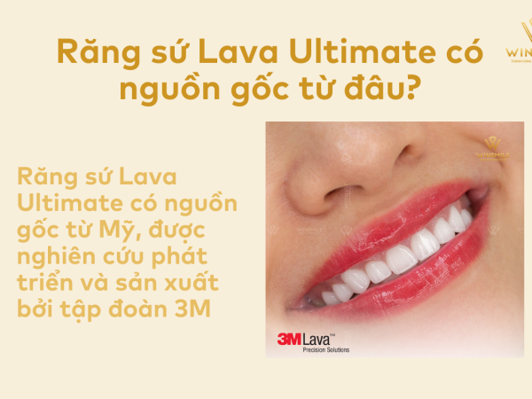 Những điều cần biết về răng sứ Lava Ultimate? Có nên bọc răng sứ Lava Ultimate không?
