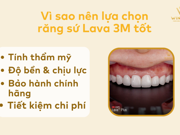 Bọc răng sứ Lava 3M ở đâu tốt? Lời khuyên từ chuyên gia dành cho bạn
