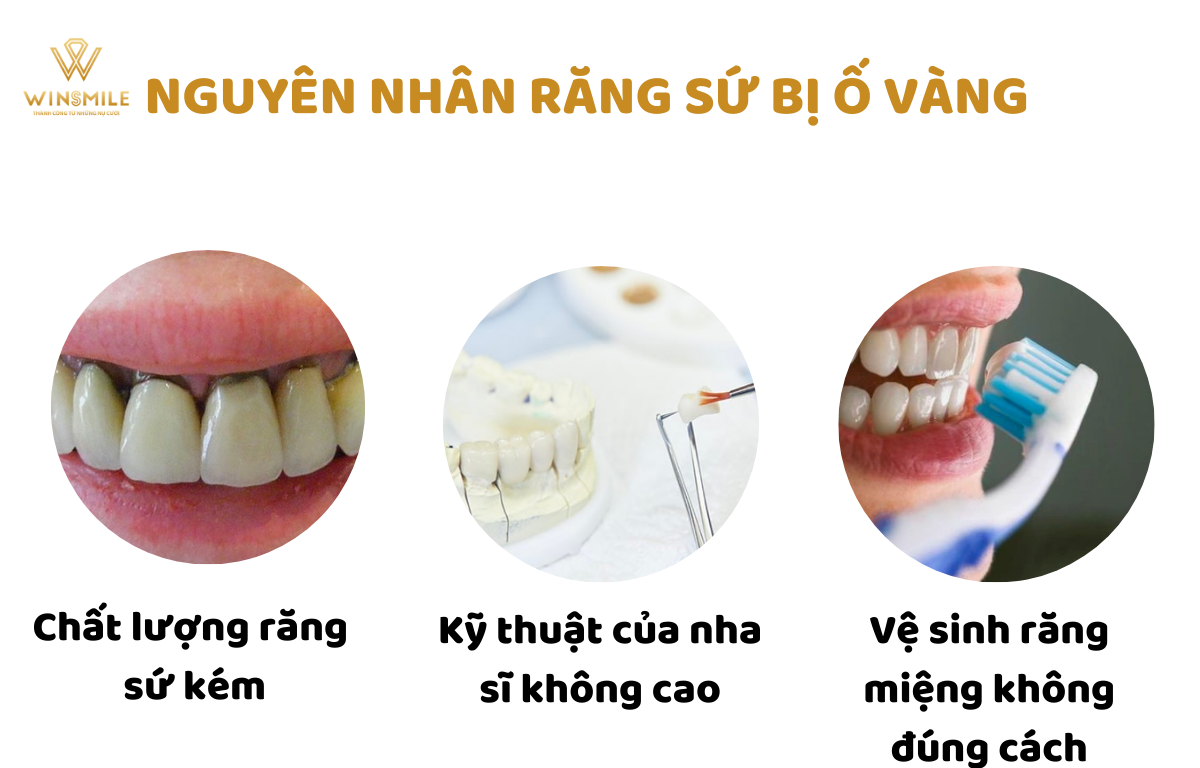 7. Các Phương Pháp Làm Trắng Răng Tại Nhà