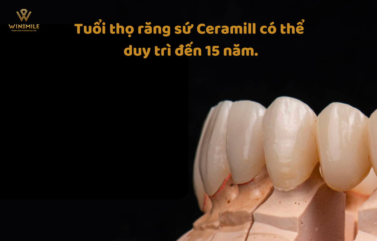 Răng sứ Ceramill có được lâu không