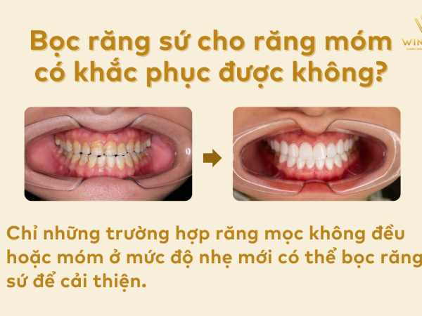 Bọc răng sứ cho răng móm trong trường hợp nào tốt và hiệu quả?