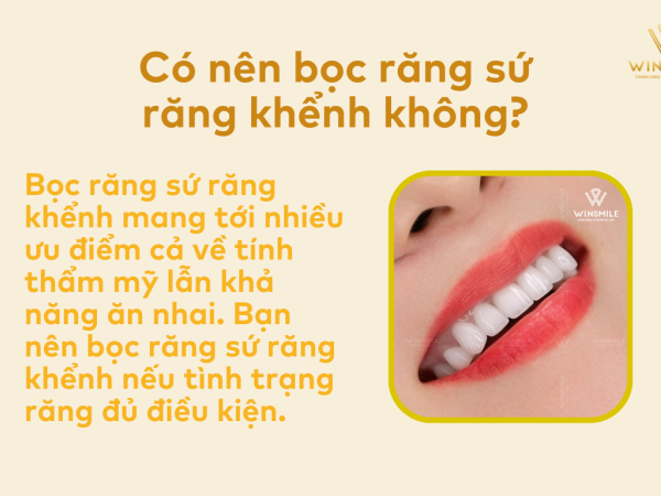 Có nên bọc răng sứ răng khểnh không?