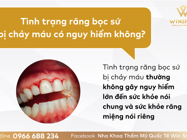 Răng bọc sứ bị chảy máu thì phải làm sao? Nguyên nhân và cách khắc phục