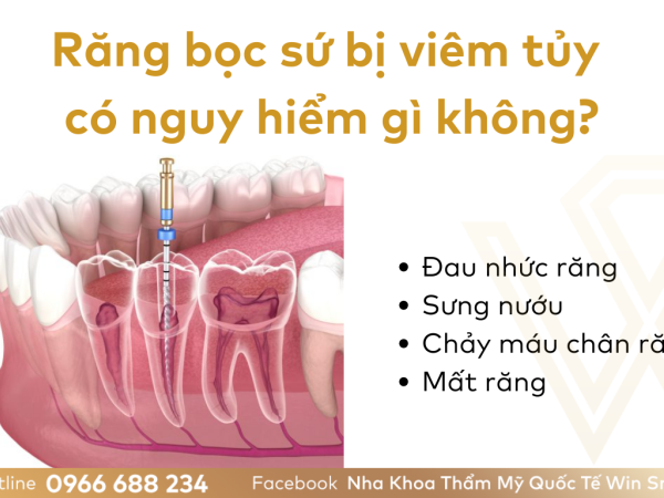 Răng bọc sứ bị viêm tủy có nguy hiểm không? Nguyên nhân và cách khắc phục