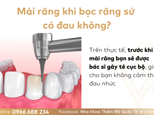 Mài răng bọc sứ có đau không? Có gây ảnh hưởng gì không?