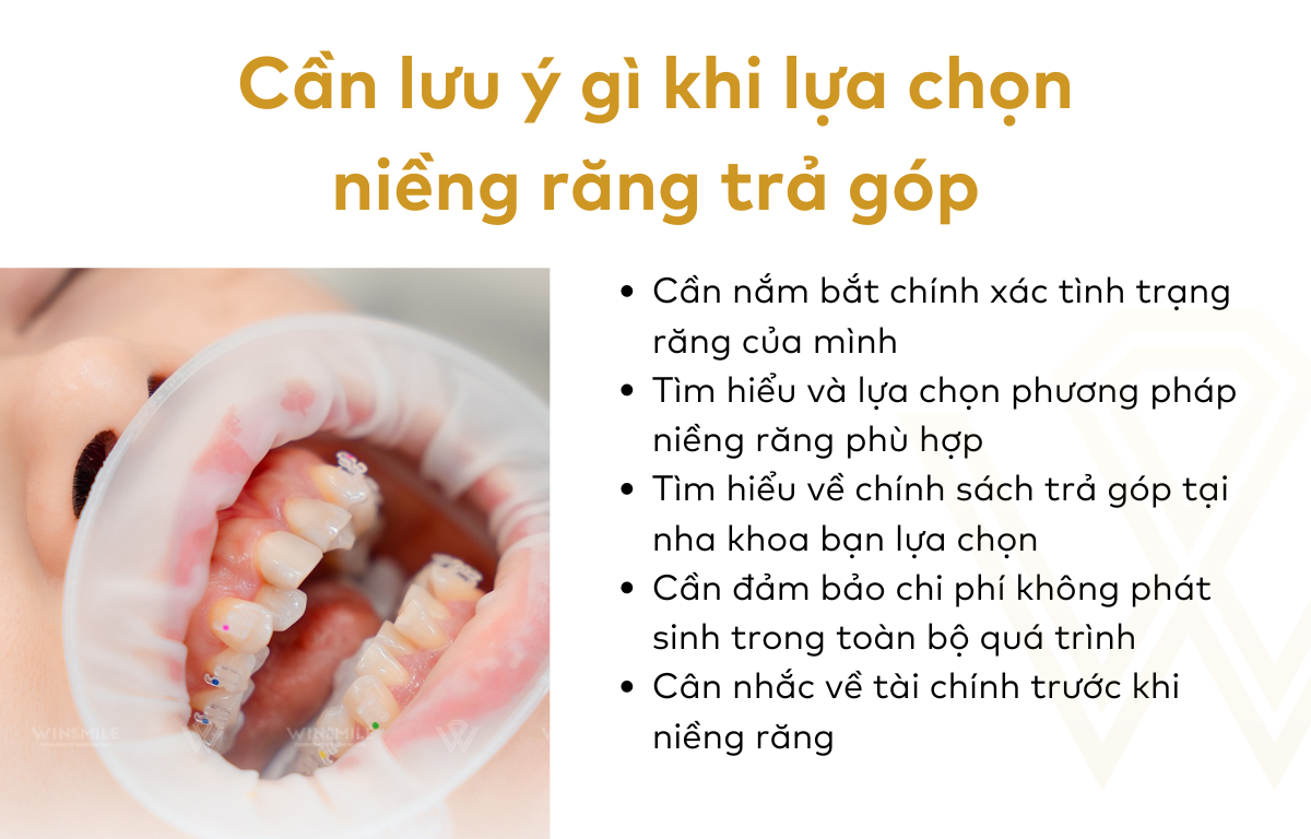 Cần lưu ý gì khi lựa chọn niềng răng trả góp