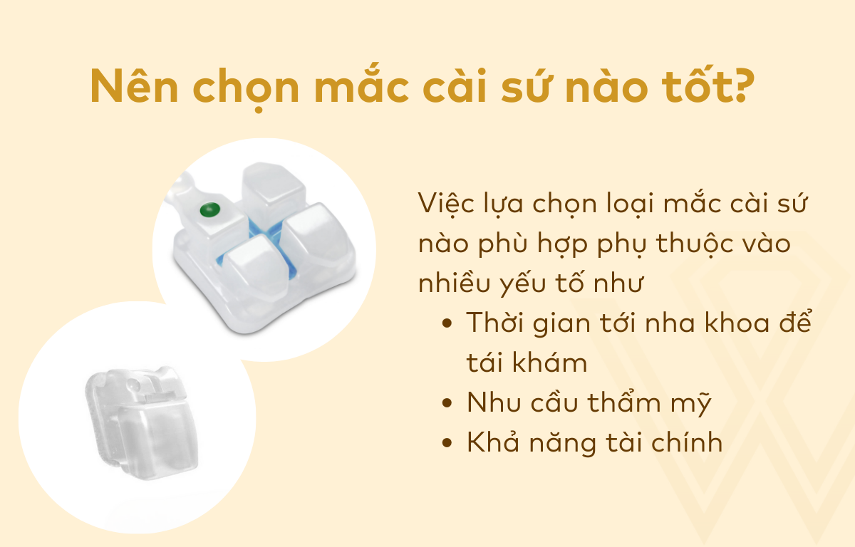 Nên chọn mắc cài sứ nào tốt