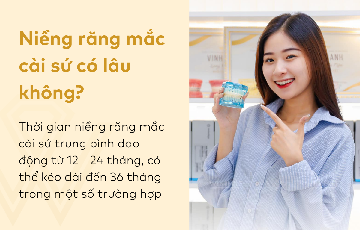 Niềng răng mắc cài sứ có lâu không