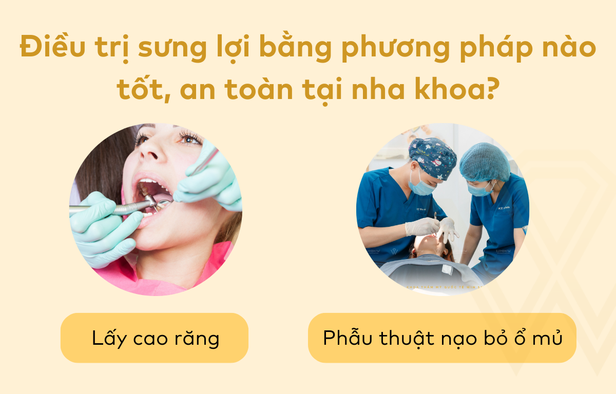 Điều trị sưng lợi bằng phương pháp nào tốt, an toàn tại nha khoa
