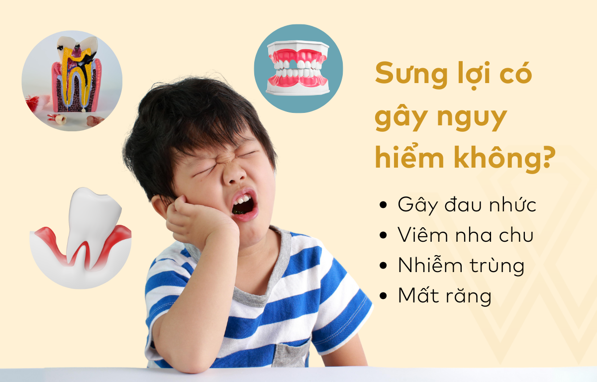 Sưng lợi có gây nguy hiểm không