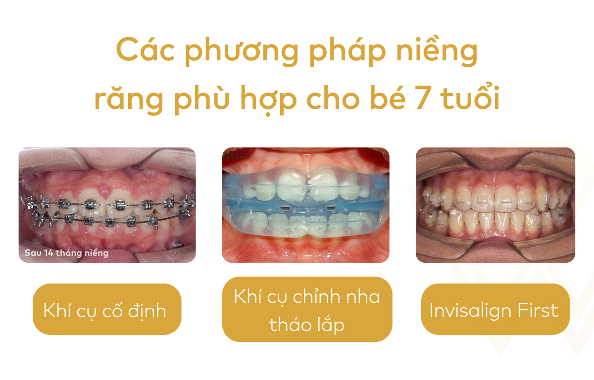 Các phương pháp niềng răng phù hợp cho bé 7 tuổi