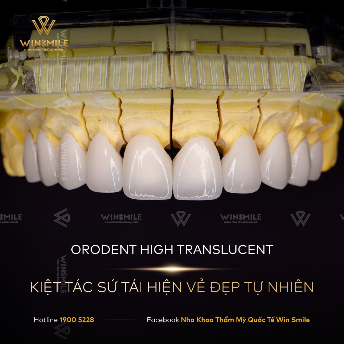 Răng sứ Orodent High Translucent - Kiệt tác sứ tái hiện vẻ đẹp tự nhiên