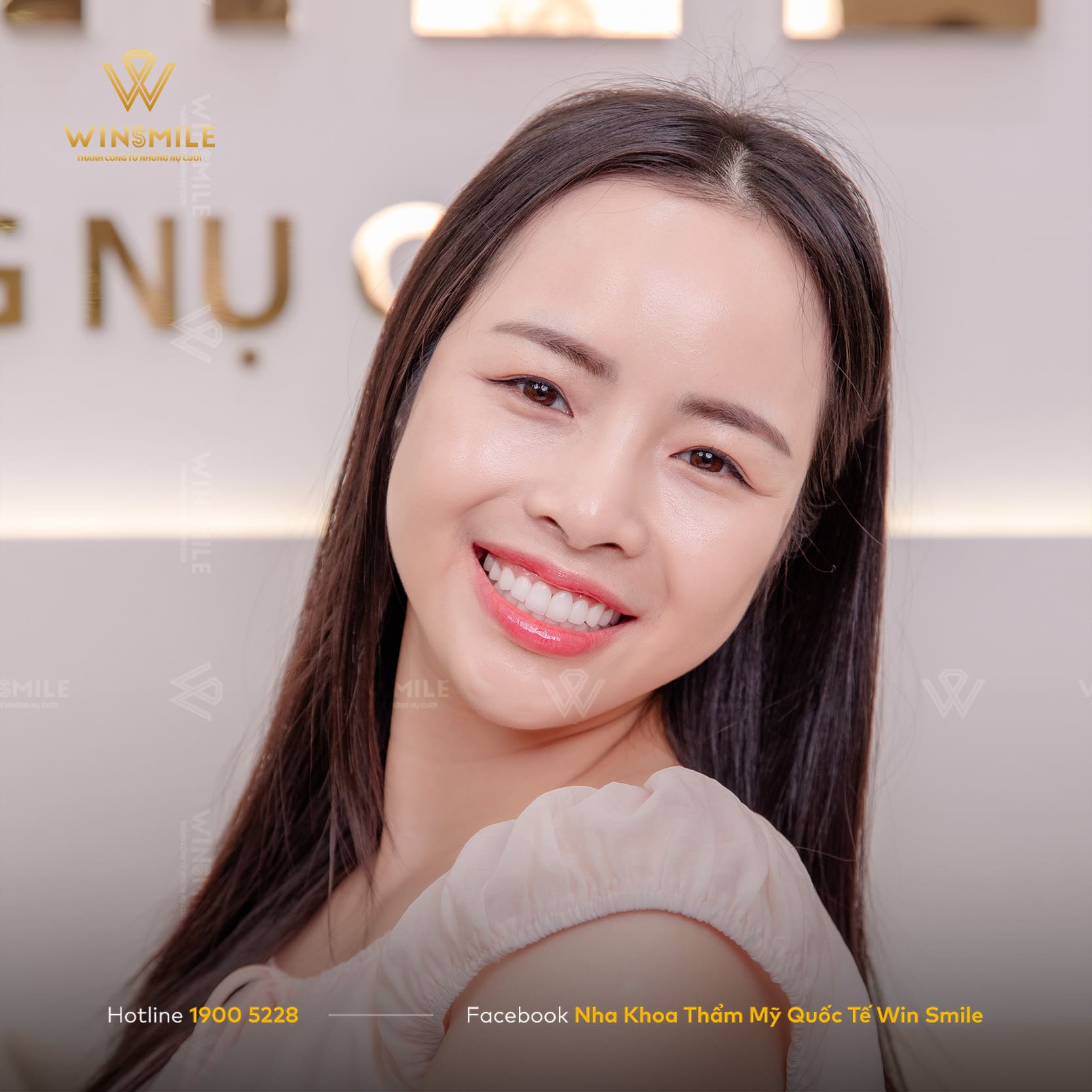 Xu hướng làm răng sứ thẩm mỹ tinh tế, tôn vinh nét đẹp của riêng mỗi người