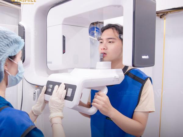 Vai trò của công nghệ CT Conebeam 3D trong trồng răng Implant