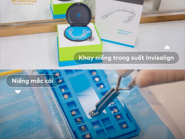 Công nghệ niềng răng số hoá: Xoá bỏ nỗi sợ mơ hồ cùng Win Smile
