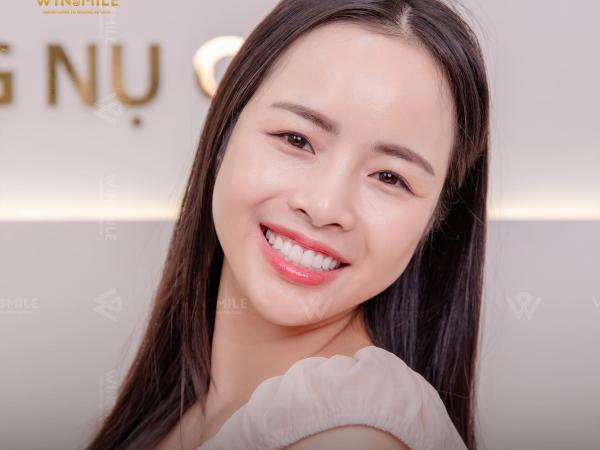 Xu hướng làm răng sứ thẩm mỹ hiện nay: Bí quyết kiến tạo nụ cười hoàn mỹ tại Win Smile