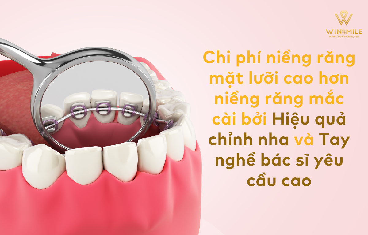 Vì sao giá niềng răng mặt lưỡi cao hơn niềng răng thông thường