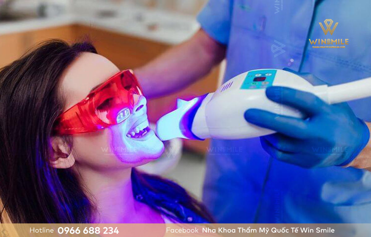 Công nghệ quyết định đến chi phí tẩy trắng răng bao nhiêu?