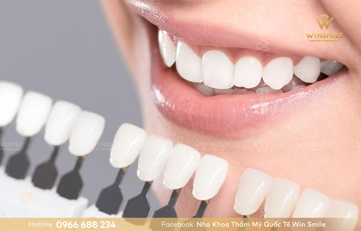 Đo màu sắc răng gốc là bước cần thiết khi tẩy trắng răng