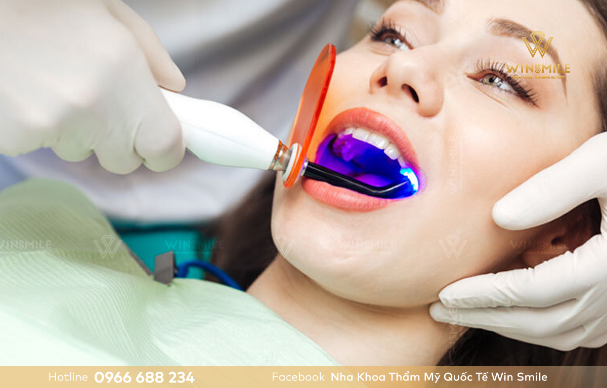 Tẩy trắng răng laser đảm bảo an toàn tuyệt đối