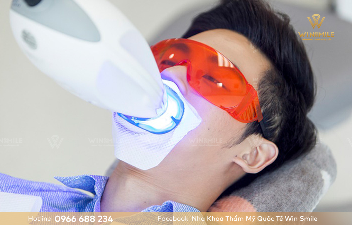 Tẩy trắng răng laser tại nha khoa an toàn, êm ái và nhanh chóng