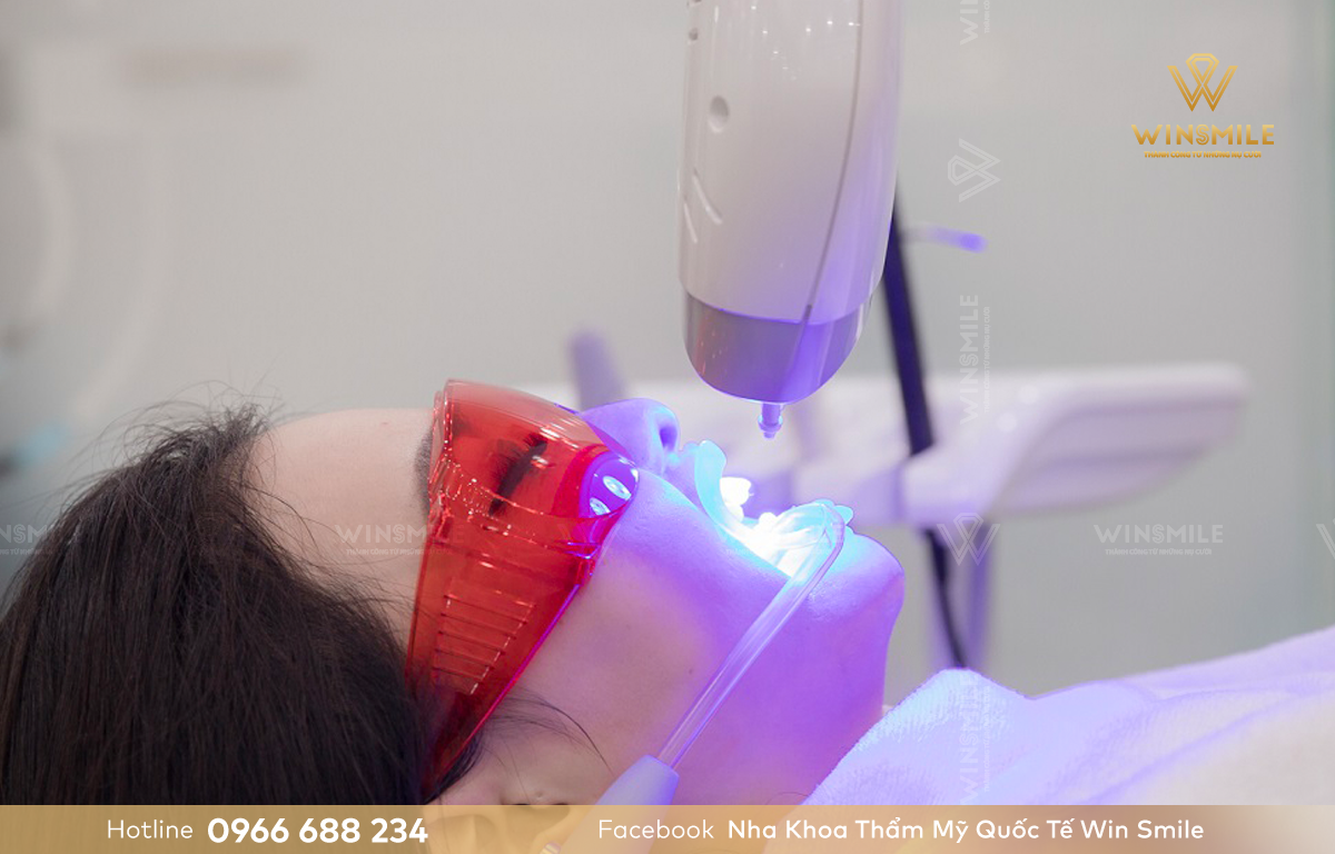 Tẩy trắng răng bằng laser là phương pháp làm trắng từ bên trong