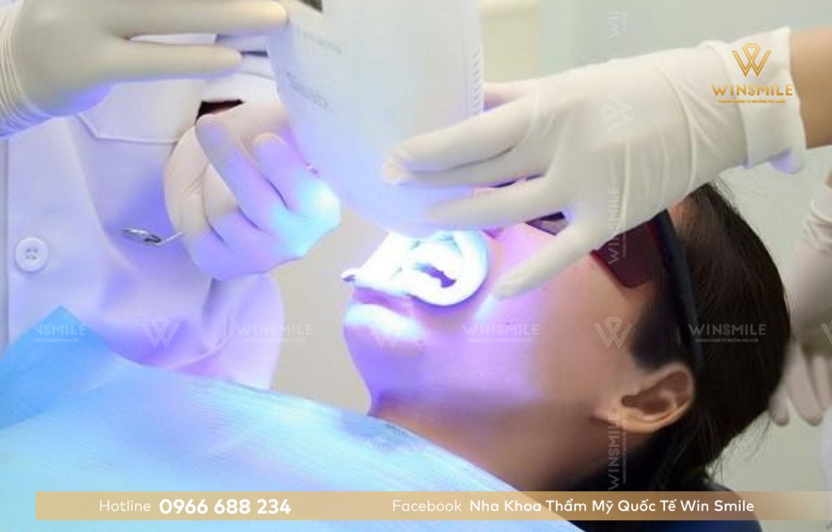 Laser Whitening - Công nghệ tẩy trắng răng mới nhất tại Nha khoa Win Smile