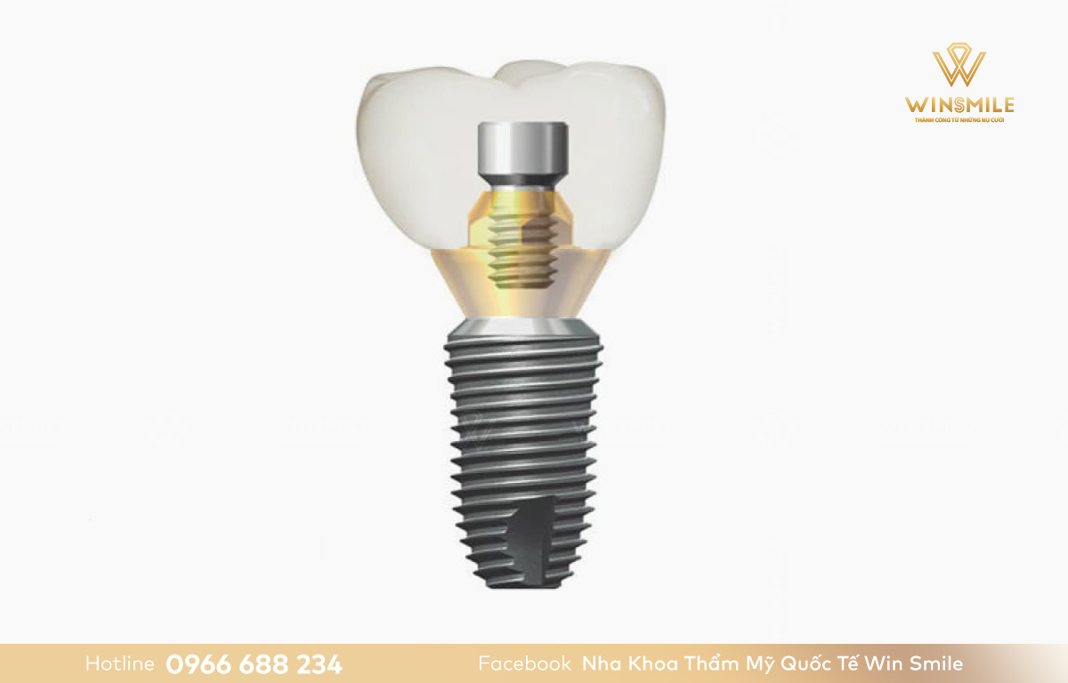 Trồng Răng Implant Dentium USA