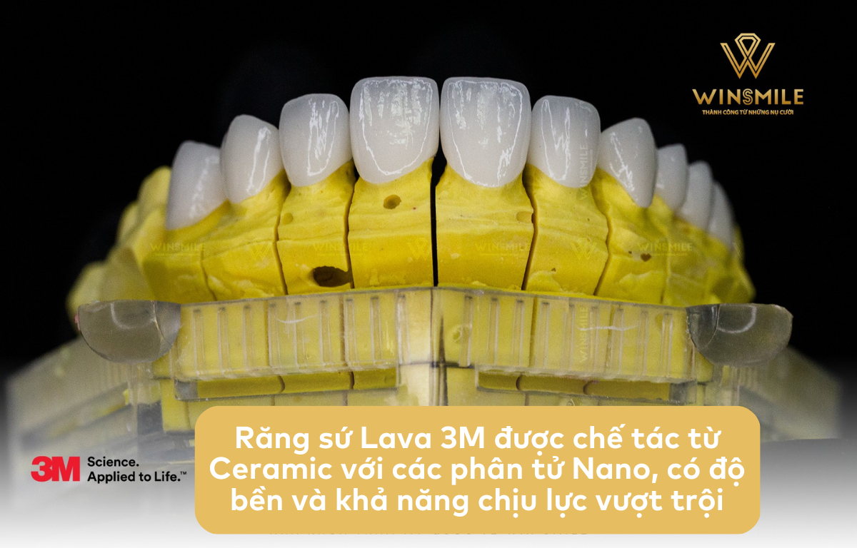 Cấu tạo của răng sứ Lava