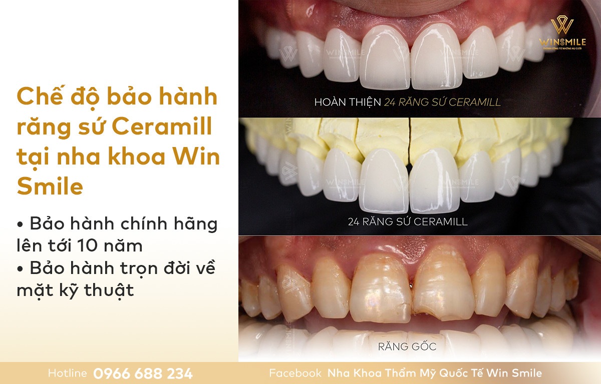 Chế độ bảo hành răng sứ Ceramill