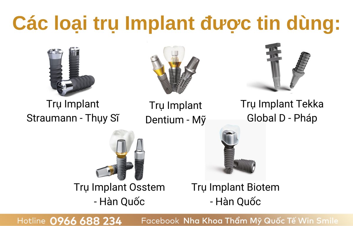 Các loại trụ Implant được tin dùng: