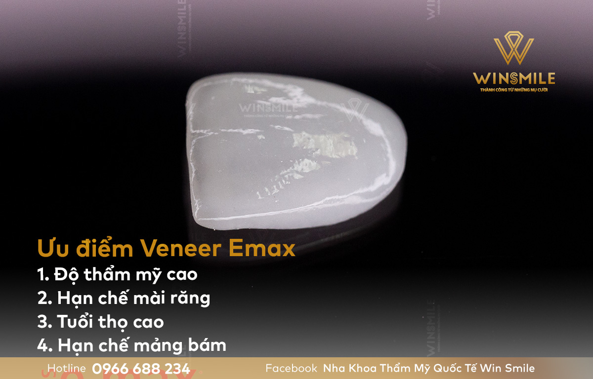 Ưu điểm của mặt dán sứ Veneer Emax