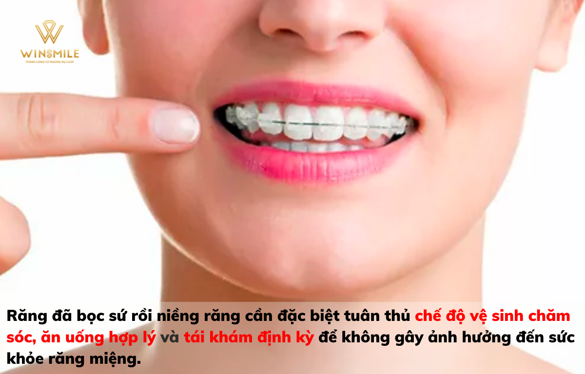Tuân thủ lưu ý khi đã bọc sứ rồi niềng răng để bảo vệ sức khỏe răng miệng 
