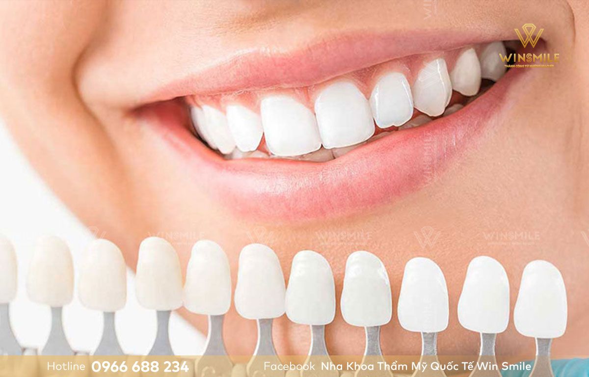 Răng sứ Fluorescent Full-Contour Zirconia tái tạo màu giống răng thật tới hơn 99%.
