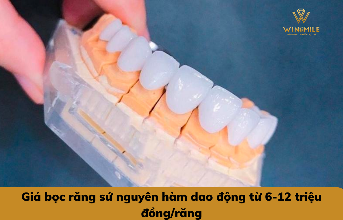 Chi phí bọc răng sứ nguyên hàm hiện nay phụ thuộc vào các yếu tố như số lượng răng, tình trạng răng...