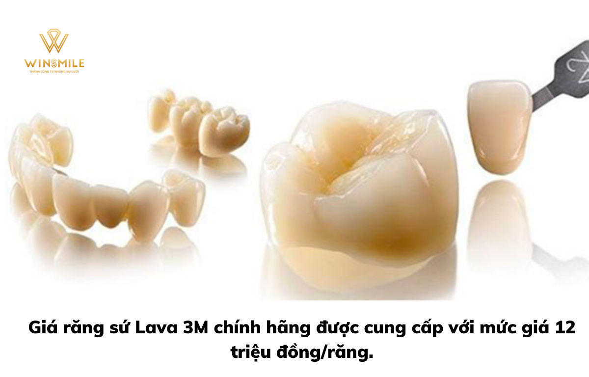 Giá răng sứ Lava 3M có giá 12 triệu đồng/răng tại nha khoa Win Smile