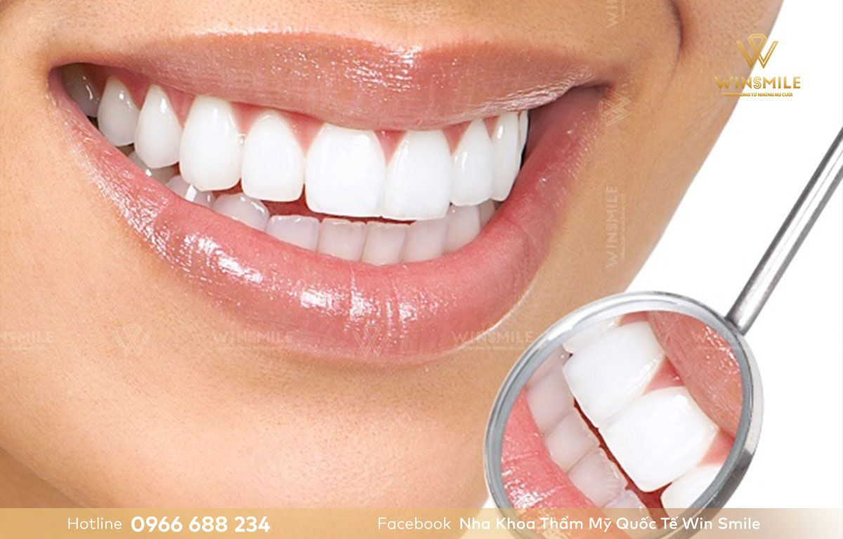 Răng sứ Ceramill đảm bảo tính thẩm mỹ cao