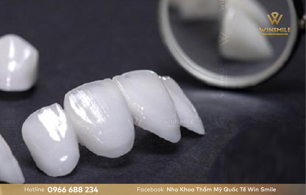 Răng sứ Katana khắc phục mọi trường hợp khuyết điểm về răng.