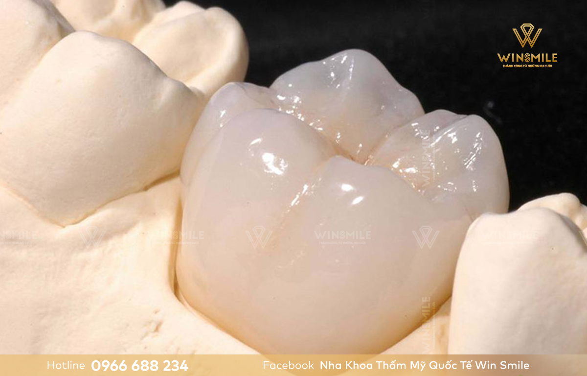 Răng sứ Katana được đánh giá cao bởi giá thành phù hợp