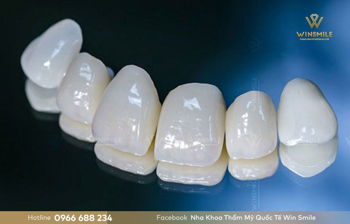 Răng sứ Lava có thể chịu được lực ăn nhai lớn hơn gấp 6-7 lần răng thật