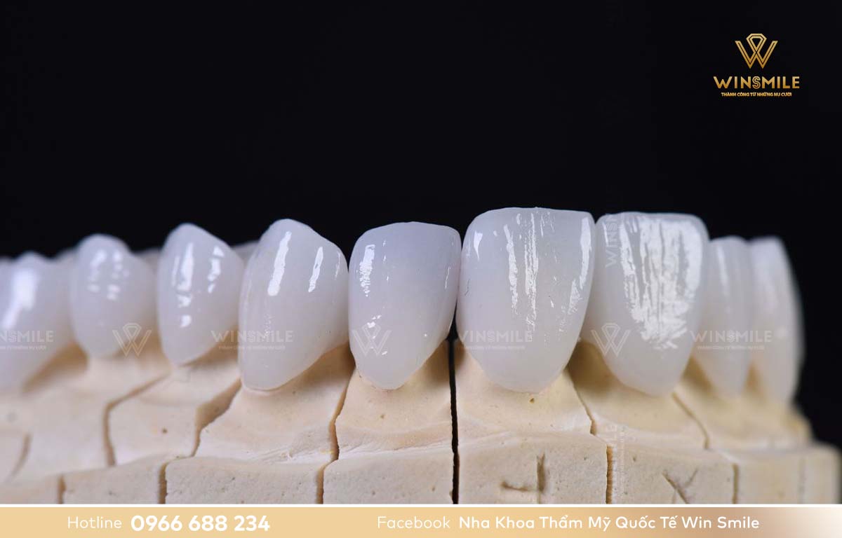 Răng sứ không kim loại DDBIO có hình dáng và màu sắc tương đồng với răng thật