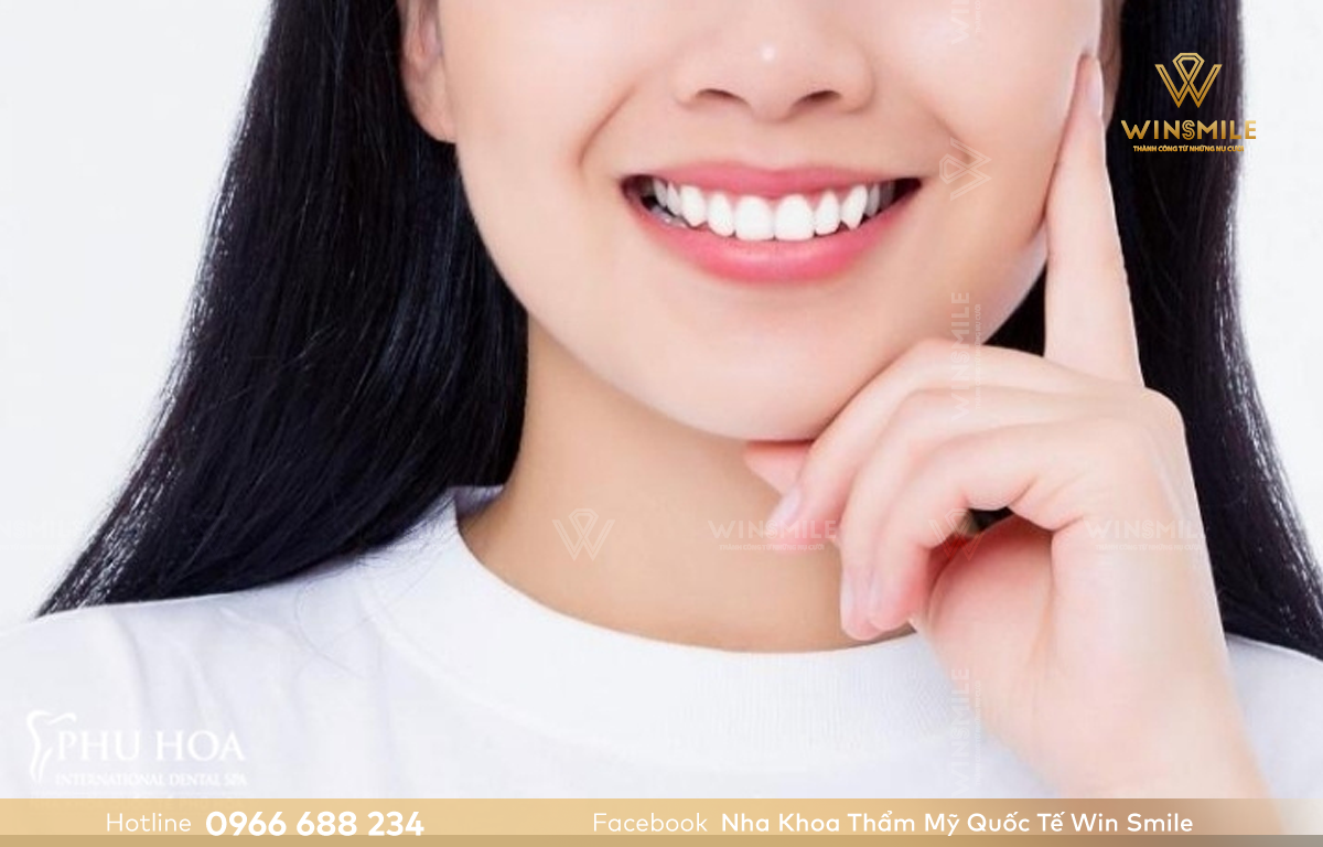 Răng sứ Ceramill đáp ứng tính thẩm mỹ, độ bền chắc do vậy có chi phí cao